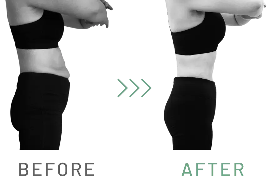 慢性的な腰痛と垂れたお尻の悩みを解決 BEFORE AFTER