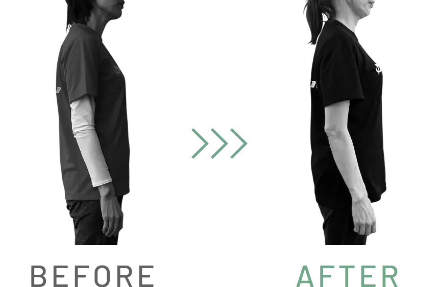 ストレートネック・巻き肩・膝痛の悩みを解決 BEFORE AFTER